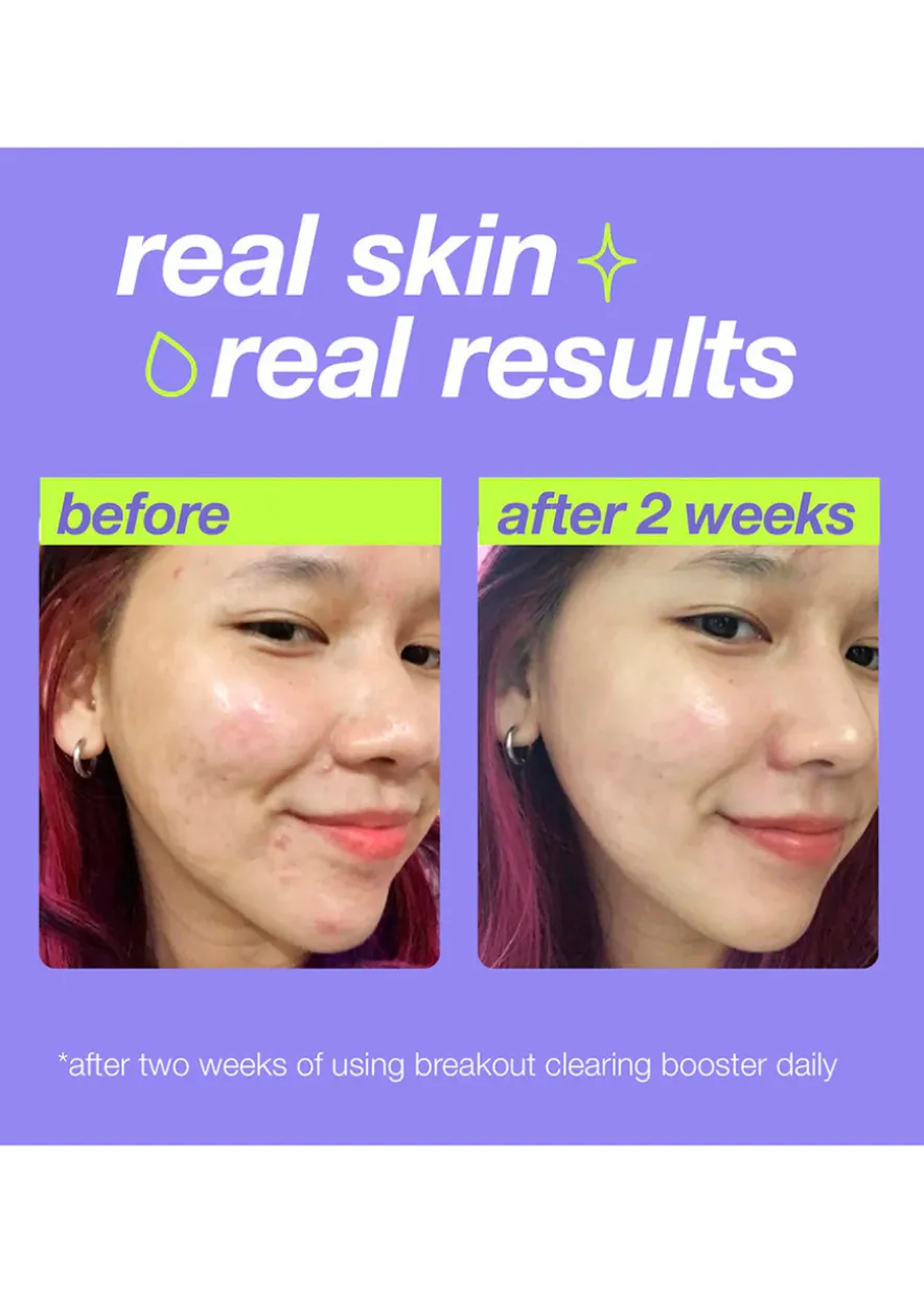 Clear Start Breakout Clearing Booster 30ml