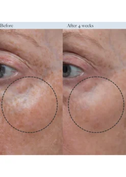 Concentrated Firming Serum