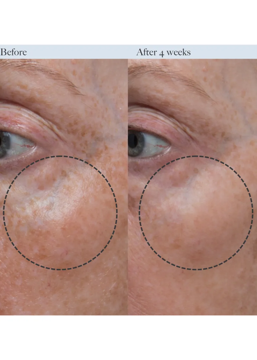 Concentrated Firming Serum