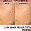 Dark Spot Correcting Radiance Recovery Serum 30ml