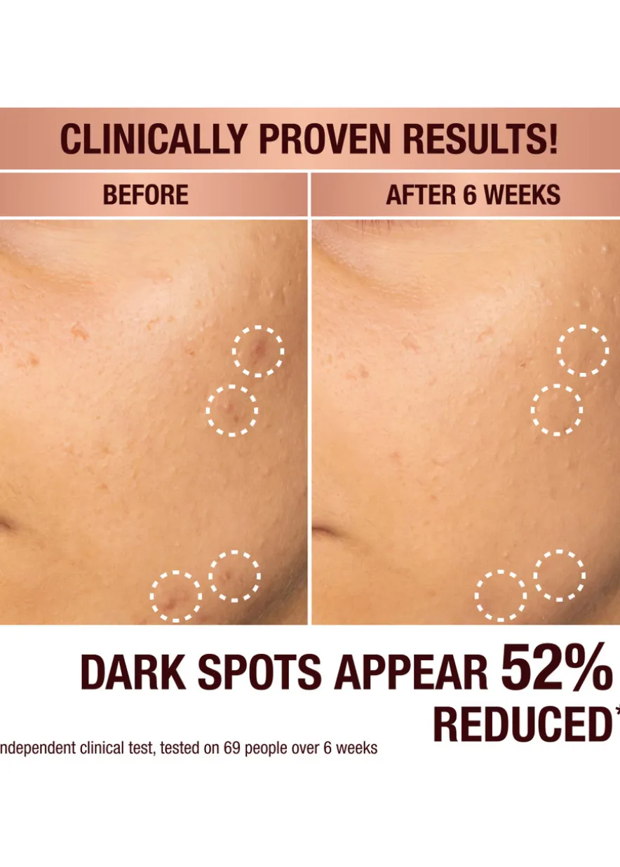 Dark Spot Correcting Radiance Recovery Serum 30ml