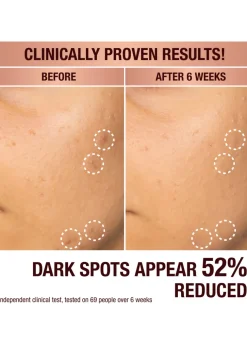 Dark Spot Correcting Radiance Recovery Serum 10ml