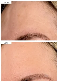 Dark Spot Correcting Serum