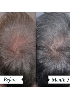 Density Preserving Scalp Drops 85ml