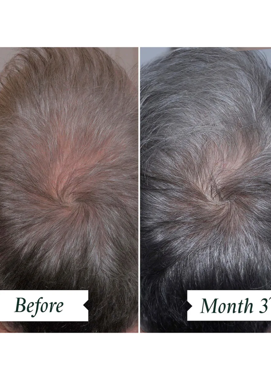 Density Preserving Scalp Drops 85ml
