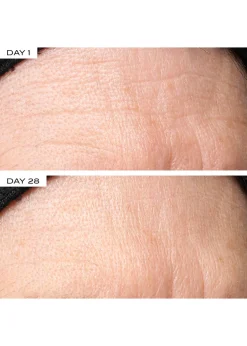 Exosome Face Lift