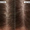 Flaky/Itchy Scalp Mask 20ml X 2