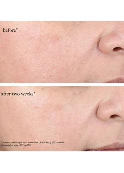 15% Glycolic Acid Overnight Glow Peel - 12 Pack