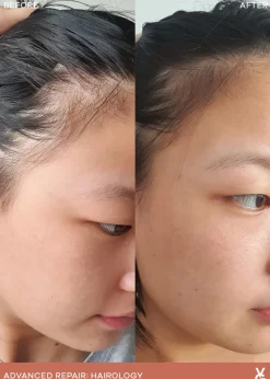 Hairology™