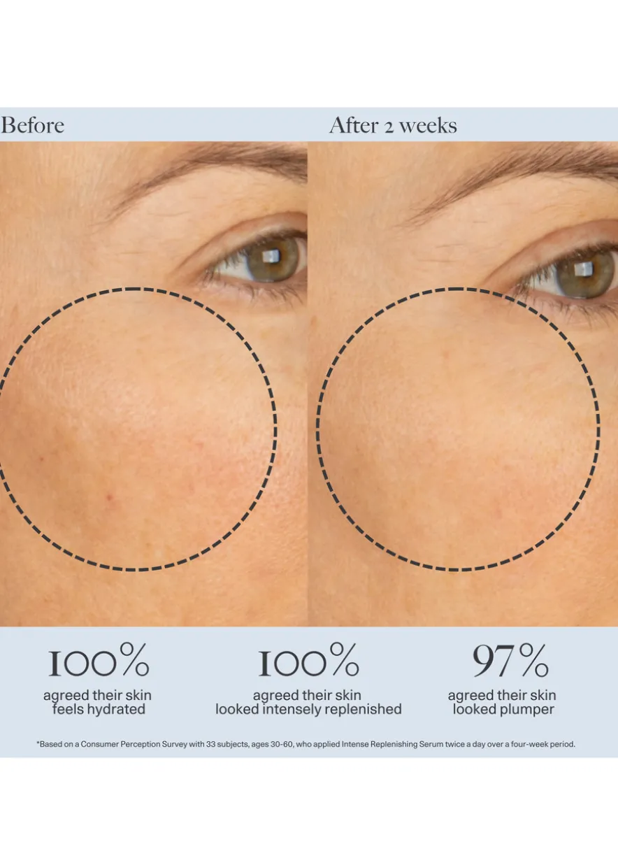 Intense Replenishing Serum