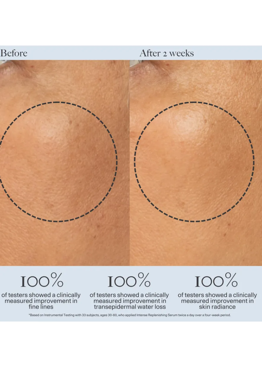 Intense Replenishing Serum