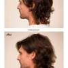 Invati Ultra Advanced™ System: Light