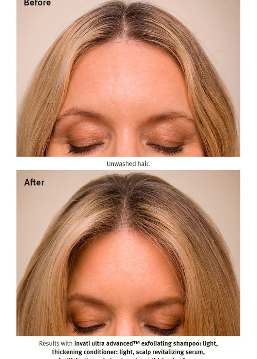 Invati Ultra Advanced™ System: Light