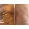 Laser Mist & Glide Refill 30 Days