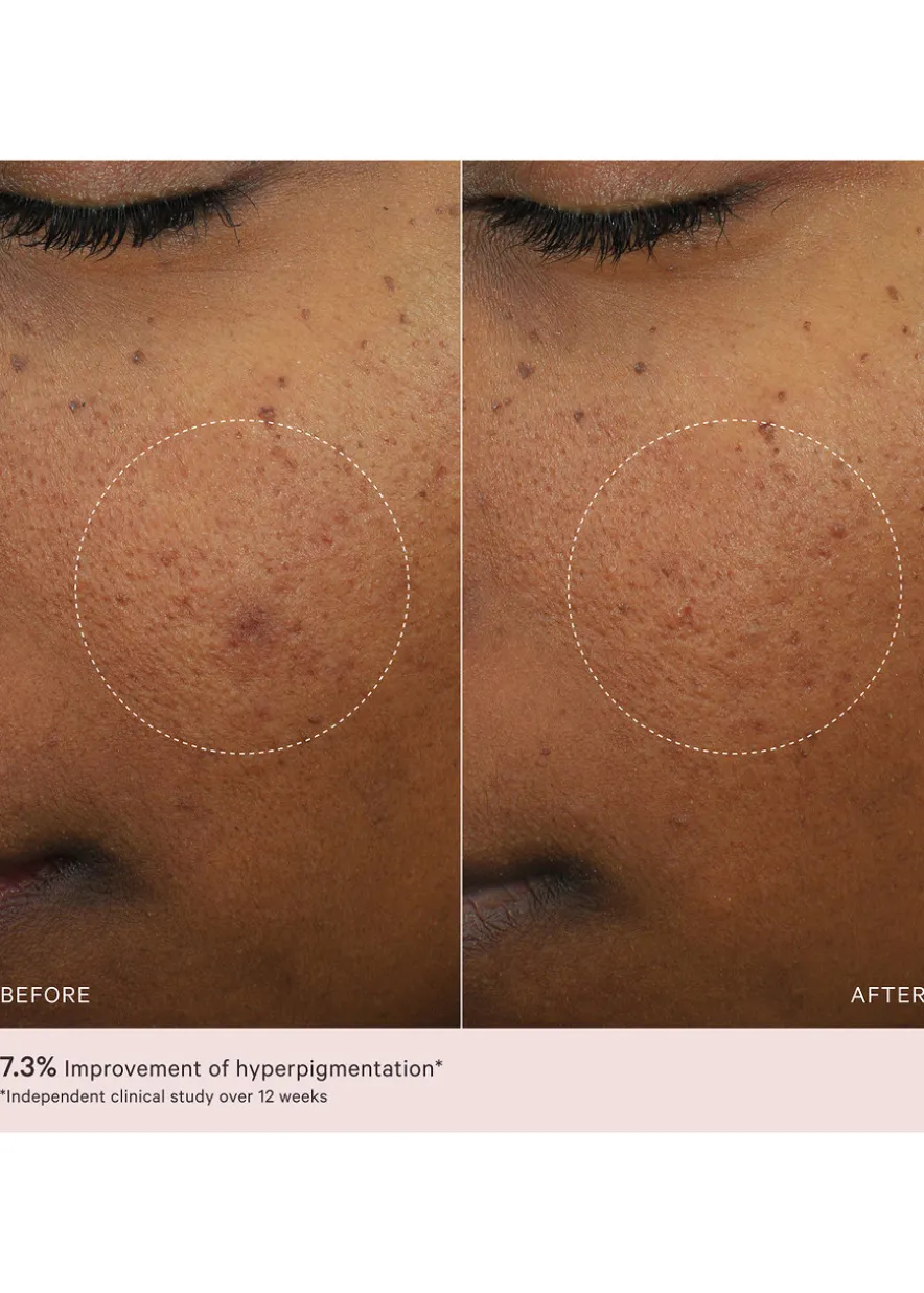 Micro Peeling Glow Essence