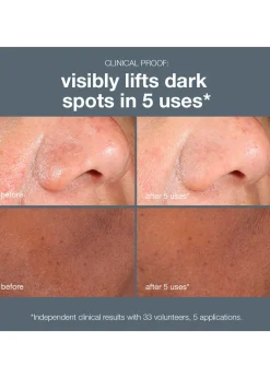 Powerbright Dark Spot Peel 50ml