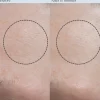 Resurfacing Enzyme Polish