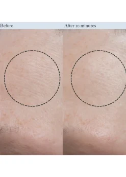 Resurfacing Enzyme Polish