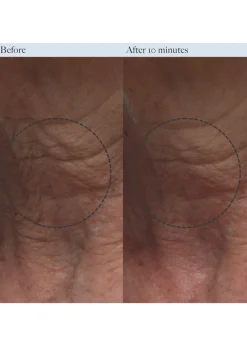 Resurfacing Enzyme Polish