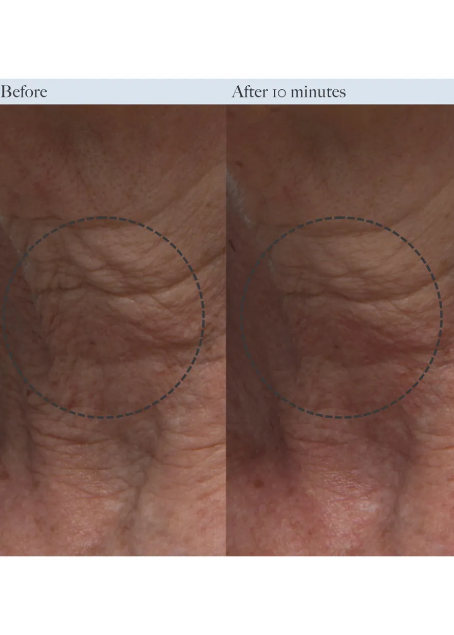 Resurfacing Enzyme Polish