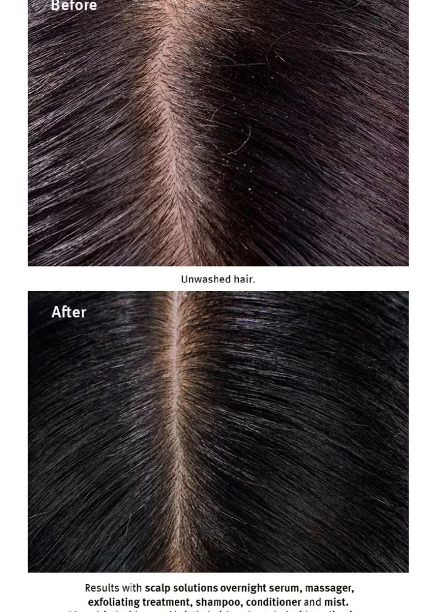 Scalp Solutions Balancing Shampoo 200ml