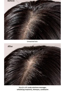 Scalp Solutions Exfoliating Scalp Treatment (Infused with Salicylic Acid) 150ml
