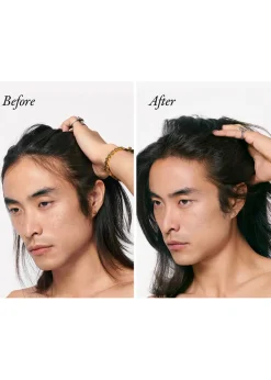 Serene Scalp Densifying Treatment