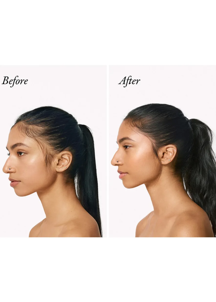 Serene Scalp Densifying Treatment