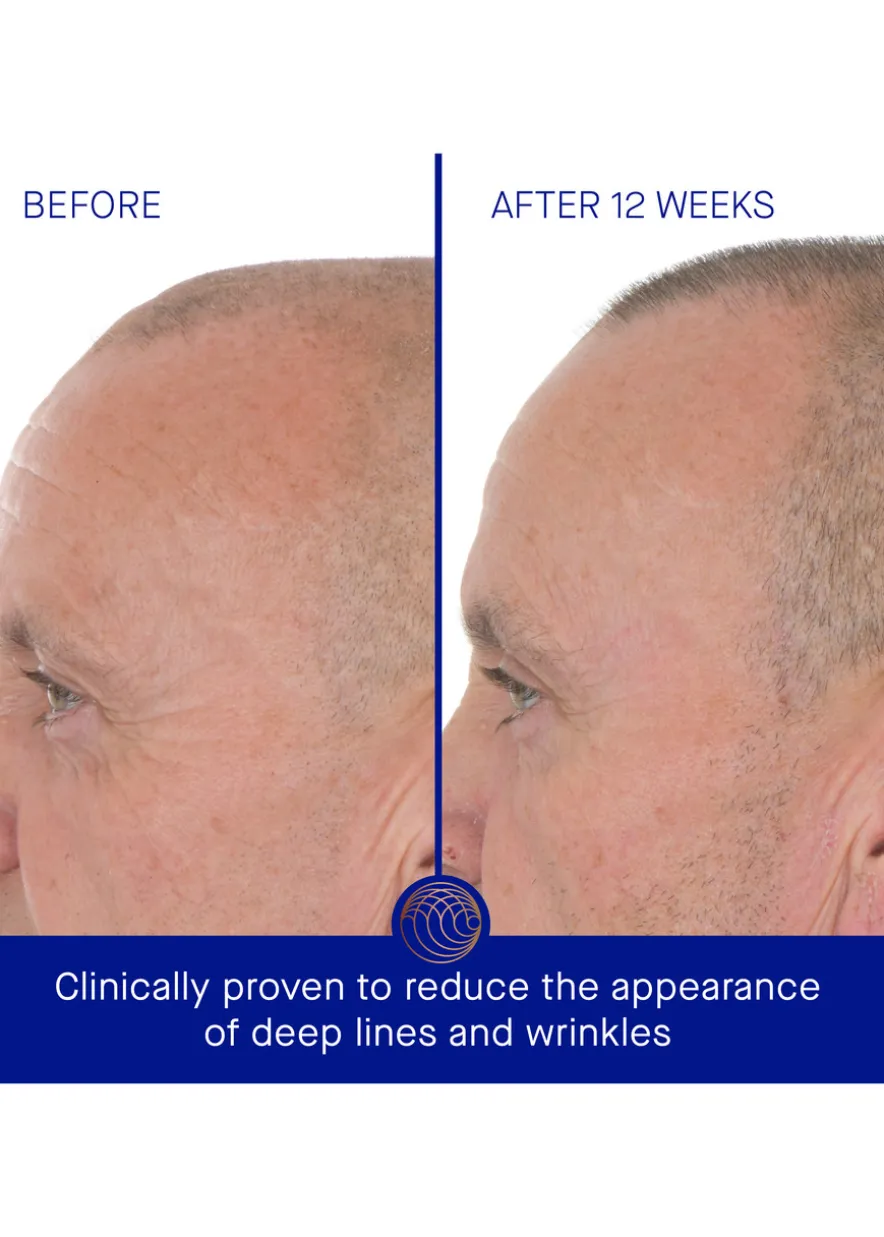 The Retinol Serum 15ml