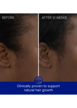 The Scalp Treatment 30ml
