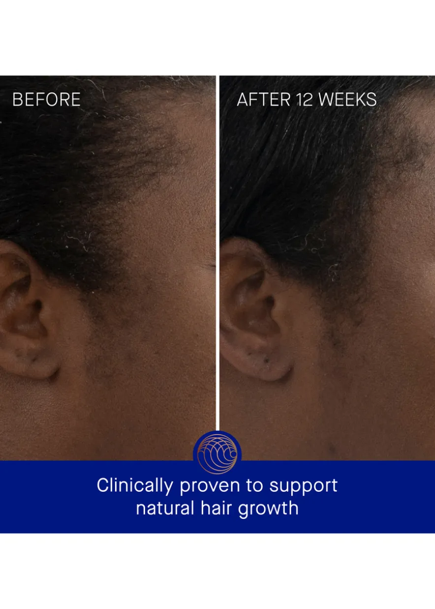 The Scalp Treatment 30ml