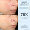TRINITY+® Effective Lip & Eye Attachment