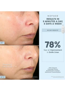 TRINITY+® Effective Lip & Eye Attachment
