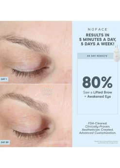 TRINITY+® Effective Lip & Eye Attachment