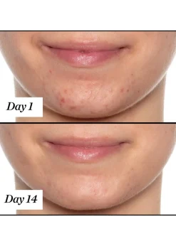 U.F.O. Ultra-Clarifying Treatment Face Oil 15ml