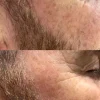 Yellow Peel Pigment Correcting Mask