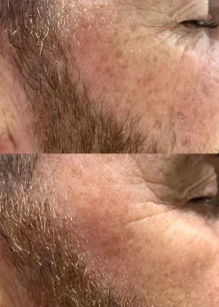 Yellow Peel Pigment Correcting Mask