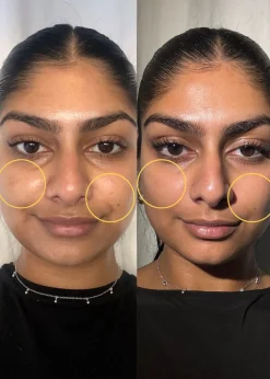 Yellow Peel Pigment Correcting Mask