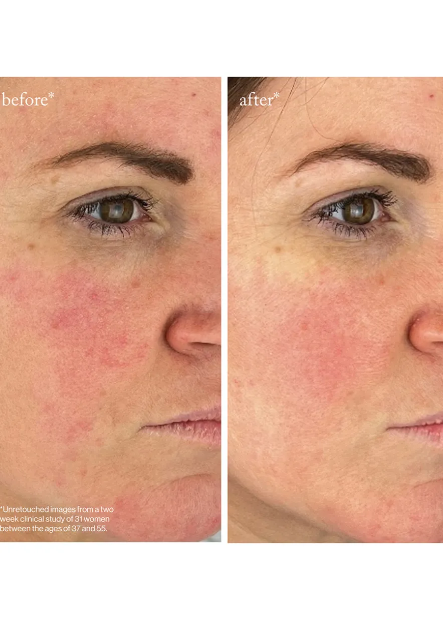 Youth-Boost Peptide Serum